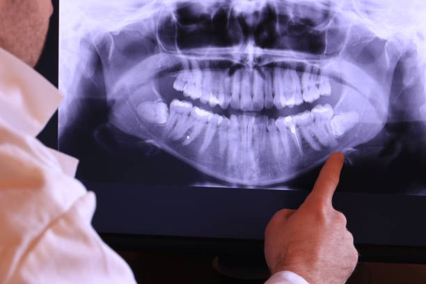 Best Emergency Dental Surgery in Frankfort, MI